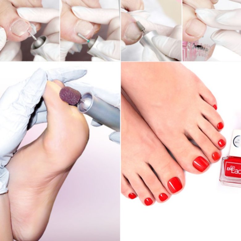 Аппаратный педикюр