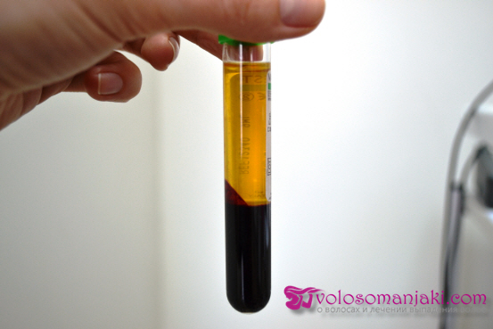 Плазмоліфтинг для волосся